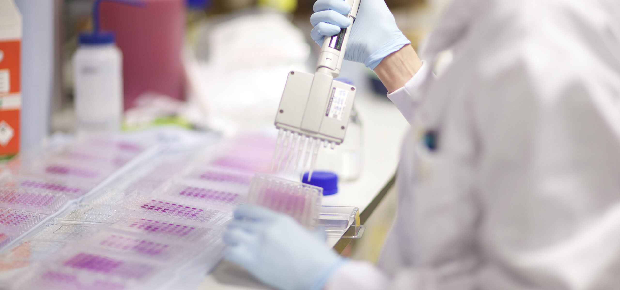 Laboratory researcher pipetting samples