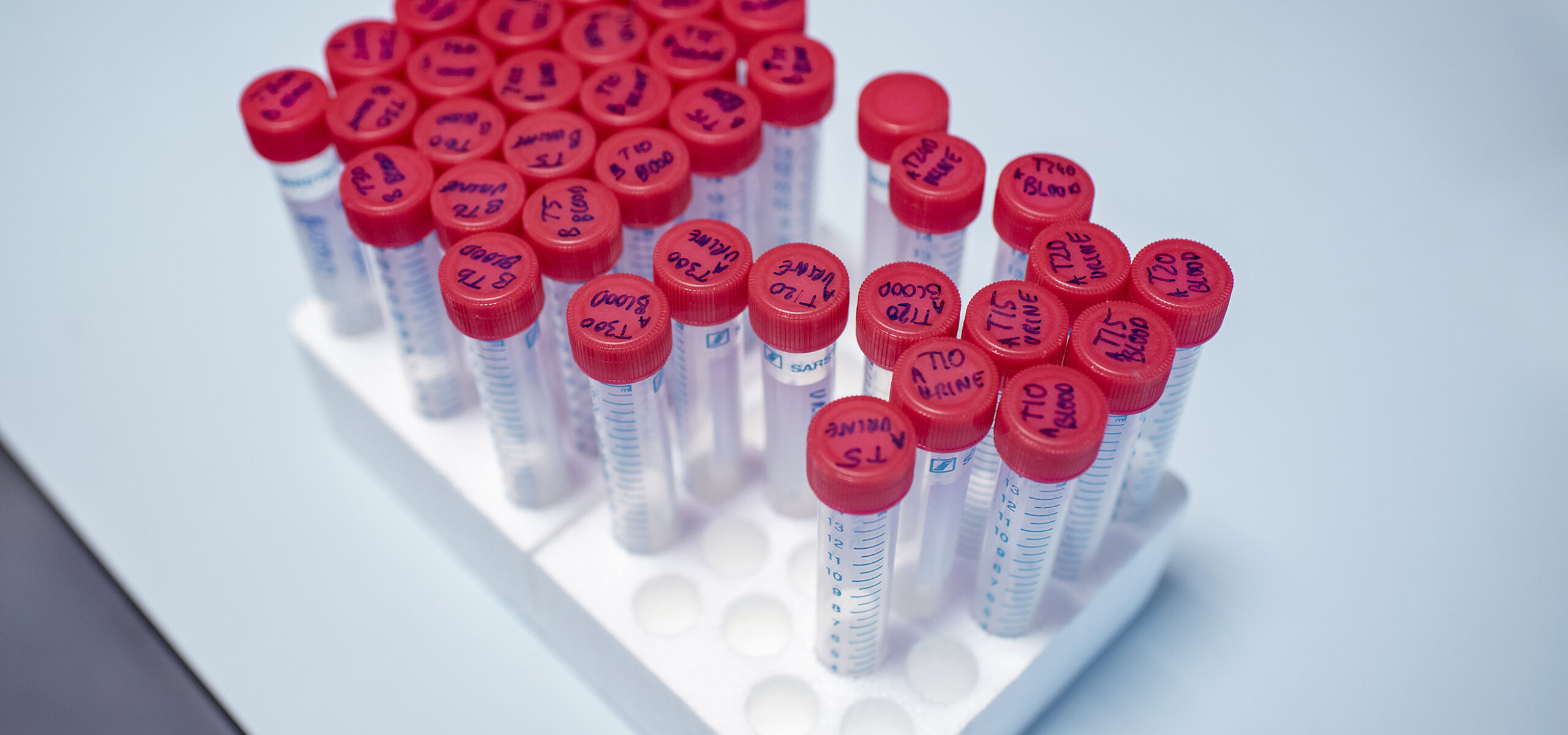 Sample tubes on a laboratory bench