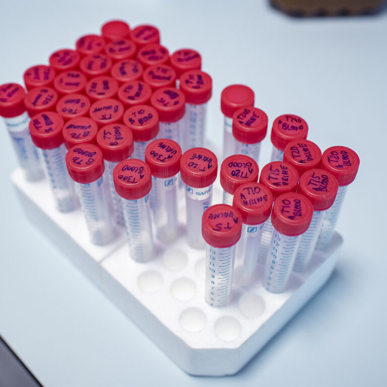 Sample tubes on a laboratory bench