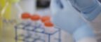 Manchester Cancer Research Centre - MCRC-DCS Alumni Showcase