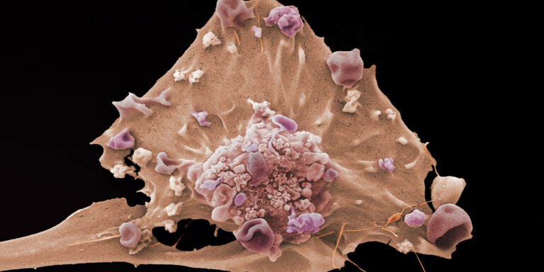 Manchester Cancer Research Centre - News