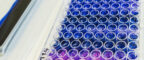 Manchester Cancer Research Centre - Gynaecological Cancer