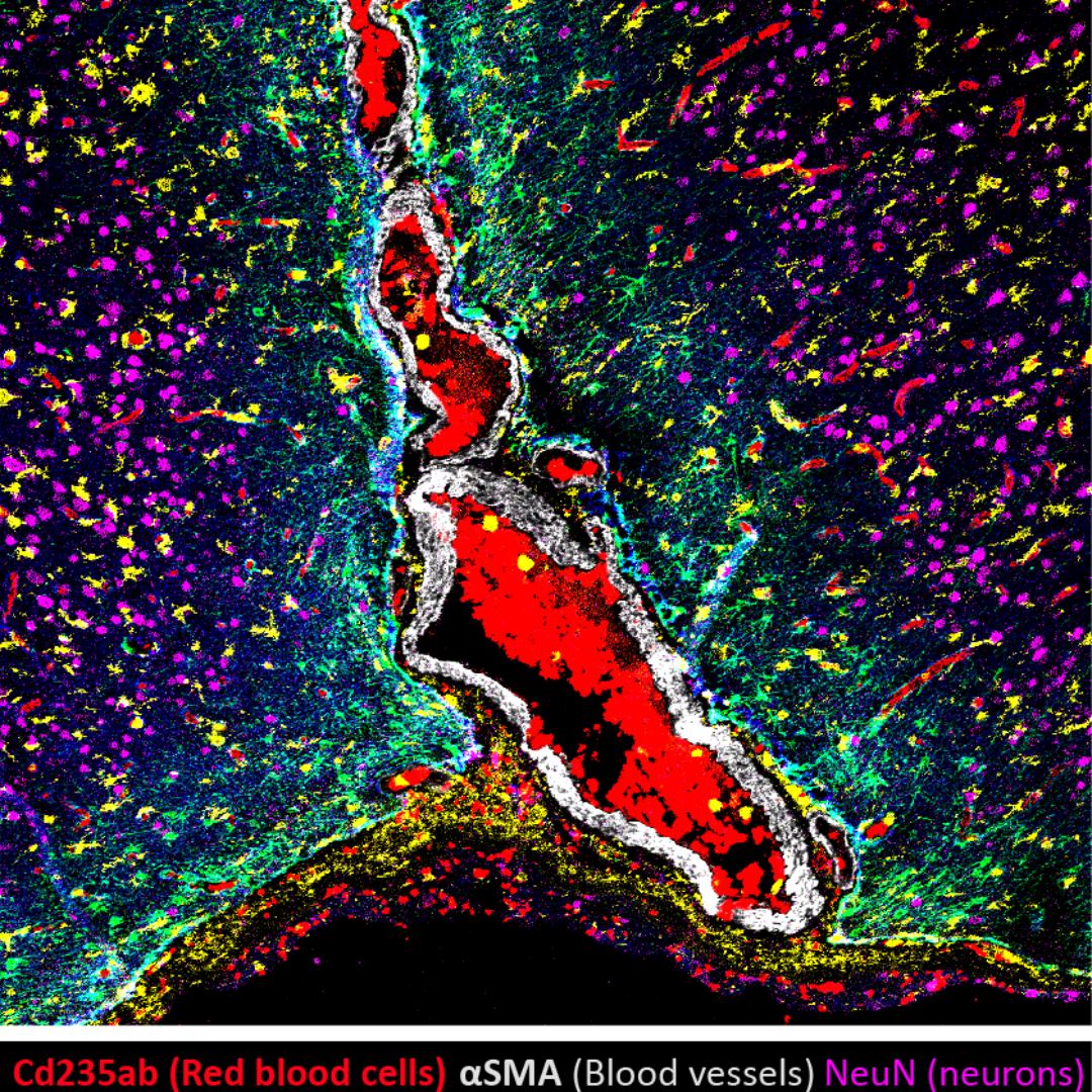 Manchester Cancer Research Centre - 