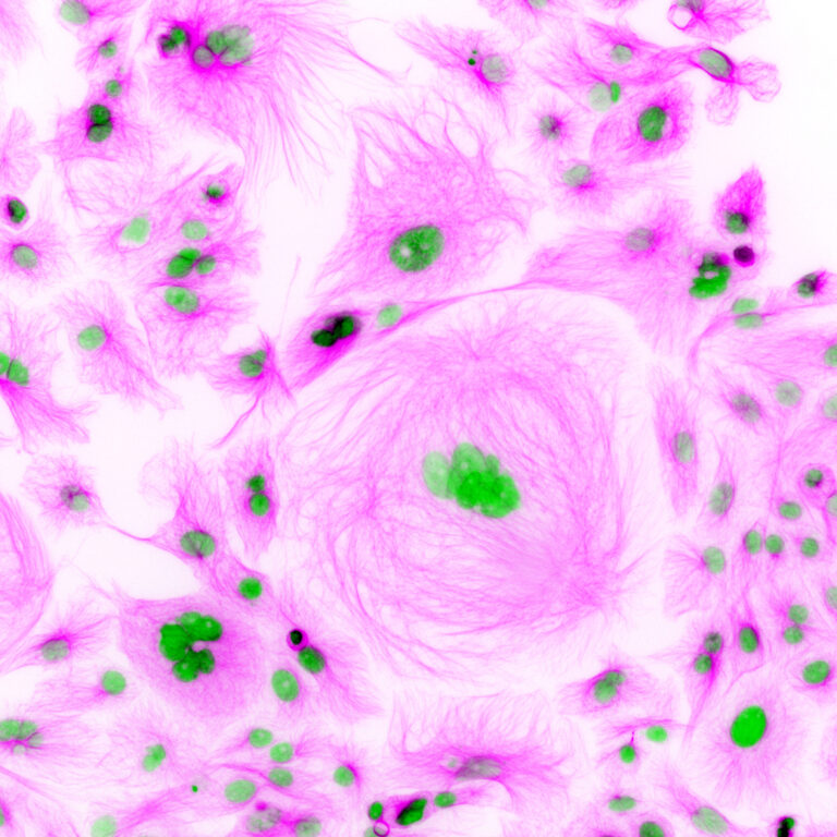 Manchester Cancer Research Centre - 