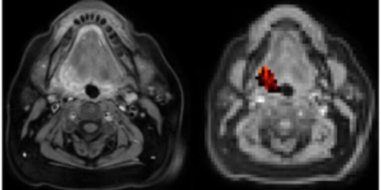 Manchester Cancer Research Centre - 