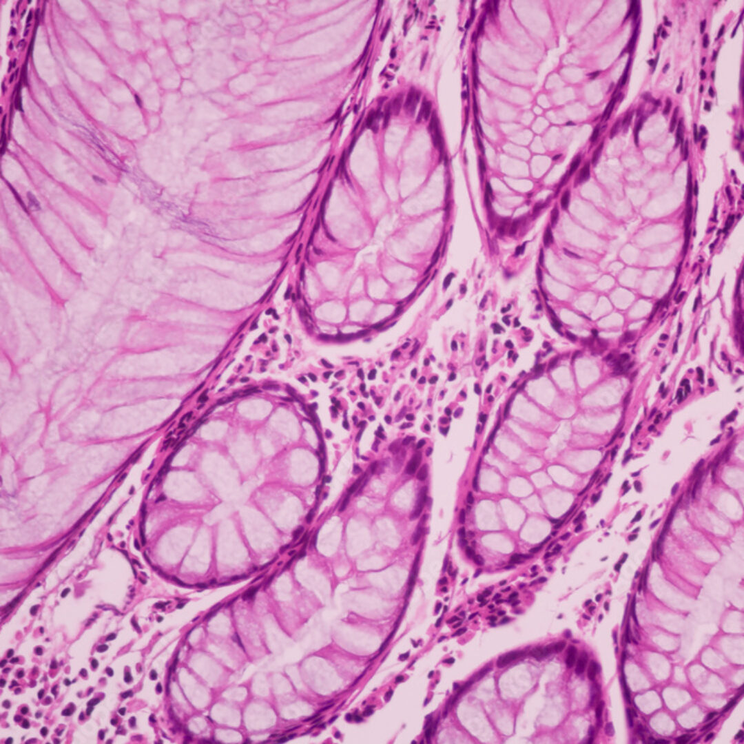 Manchester Cancer Research Centre - News