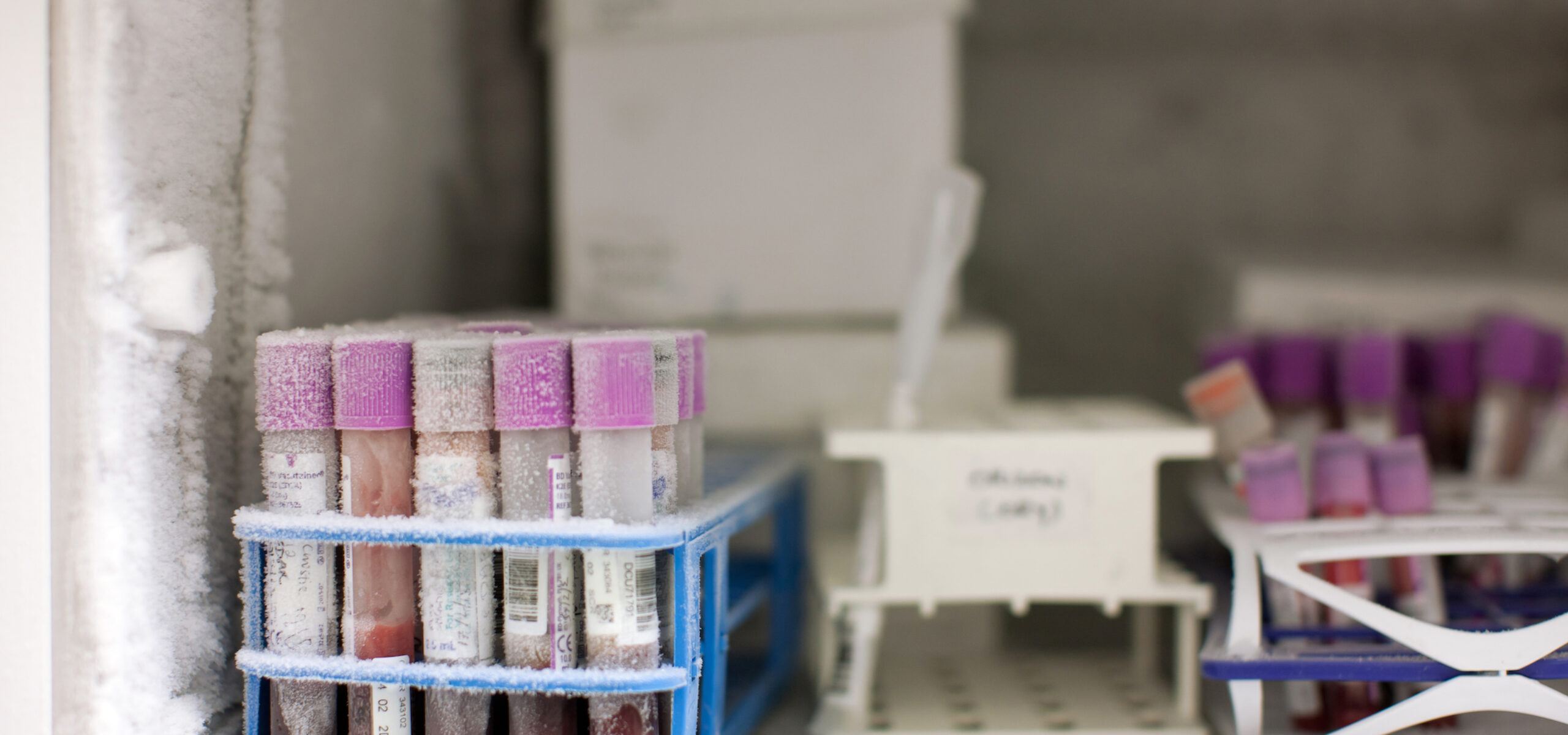 Blood samples located within a freezer within the laboratory