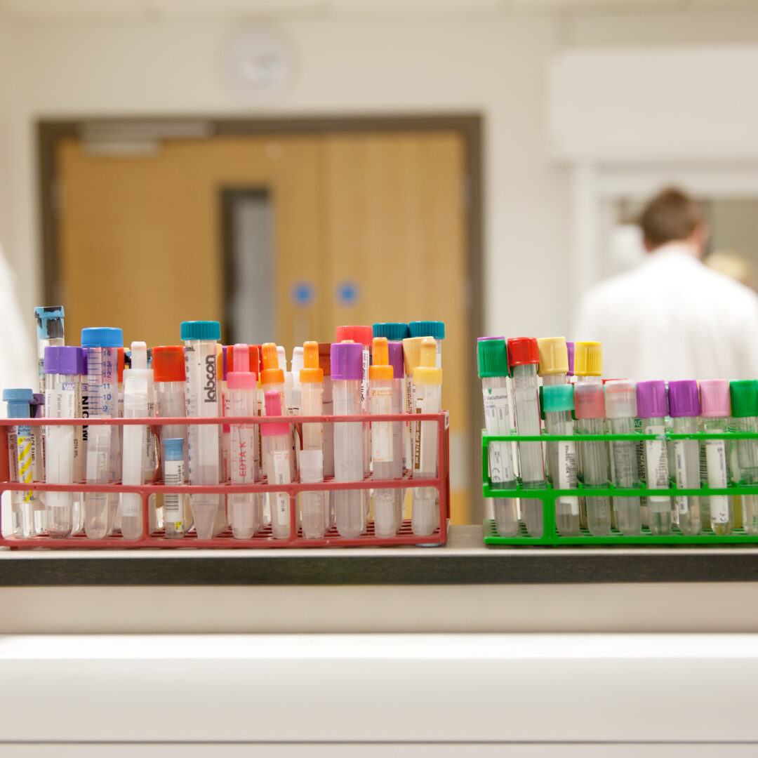 Manchester Cancer Research Centre - News