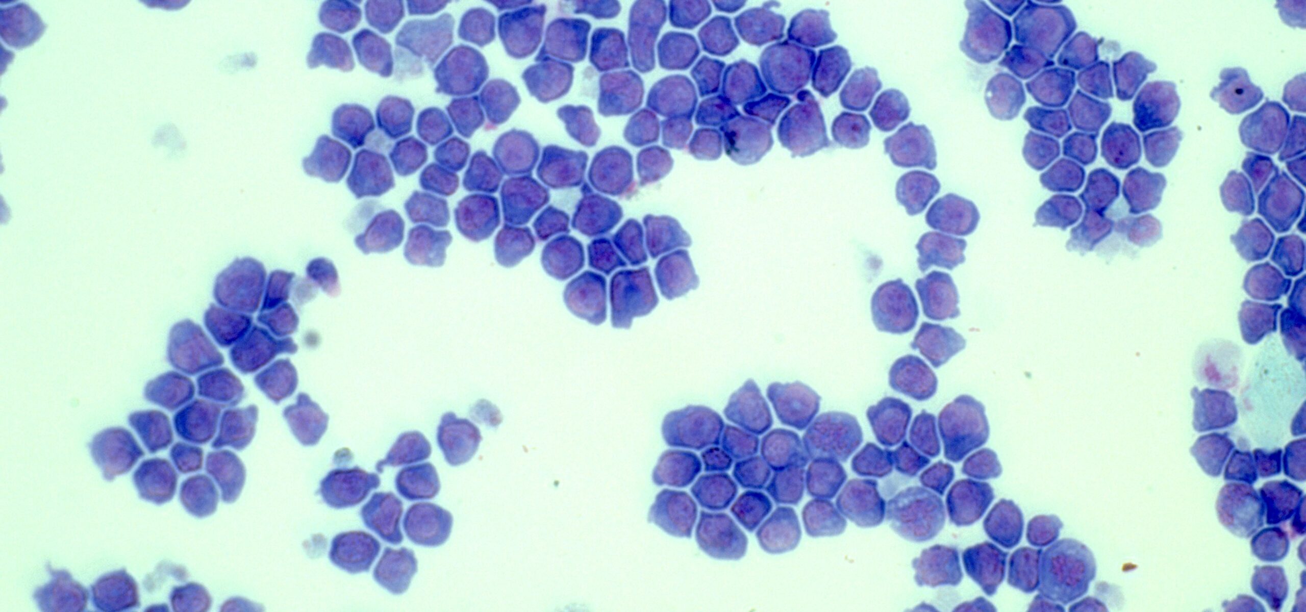 Manchester Cancer Research Centre - News