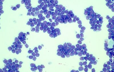 Manchester Cancer Research Centre - Homepage