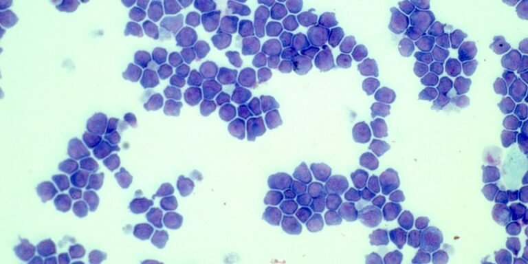 Manchester Cancer Research Centre - News