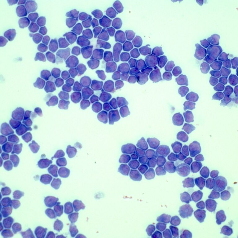Manchester Cancer Research Centre - 